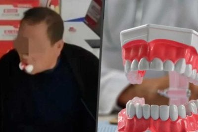 Li mendakwa dia terkejut apabila kesemua 12 batang giginya dicabut dalam satu prosedur sebelum dipasang 10 implan gigi. - Foto: South China Morning Post.