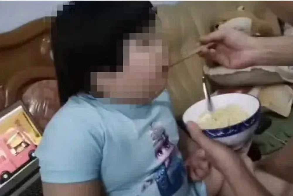 Berat badan kanak-kanak itu meningkat kepada 35 kilogram lebih dua kali ganda berbanding berat normal kanak-kanak seusianya. Foto Xiaopeiqi de Yitian
