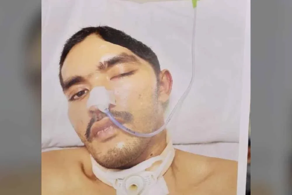Abdul Hamid mengalami kecederaan otak traumatik yang teruk sehingga menyebabkan lumpuh pada keempat-empat anggota badan.