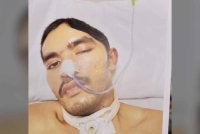 Abdul Hamid mengalami kecederaan otak traumatik yang teruk sehingga menyebabkan lumpuh pada keempat-empat anggota badan.