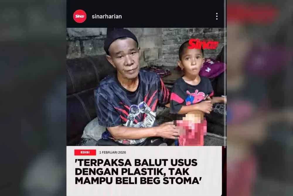 Kisah derita Adam turut disiarkan Sinar Harian melalui platform media sosial.