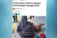Laporan Sinar Harian mengenai kanak-kanak melecur akibat kemalangan dengan RXZ. 