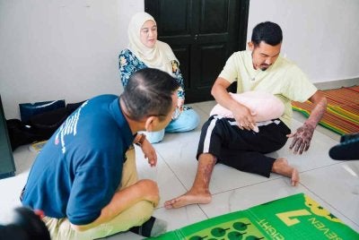 Muhammad Muzaffarudin menunjukkan kesan melecur yang dialami kepada pihak Timbalan Ketua Pegawai Eksekutif (Operasi) PERKESO, Azirruan Arifin yang berkunjung menziarahinya pada Jumaat. 