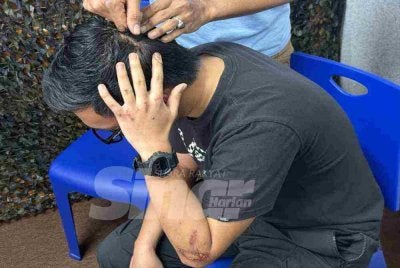 Jahitan kecederaan di kepala mangsa berusia 29 tahun. 