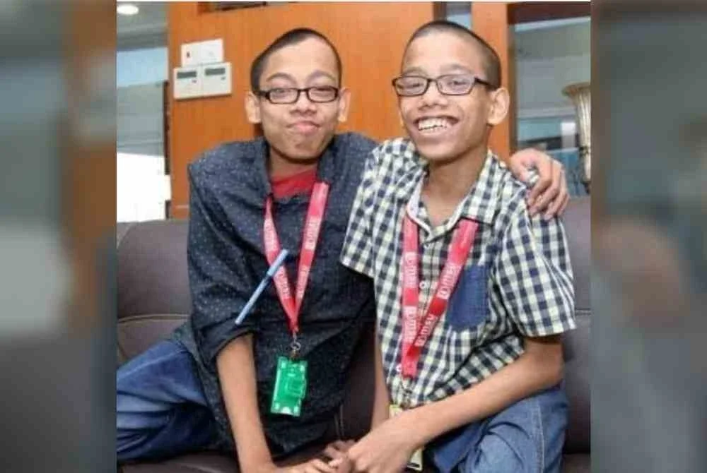 Pasangan kembar siam Muhammad dan Ahmad pernah menggemparkan negara. Foto tular.