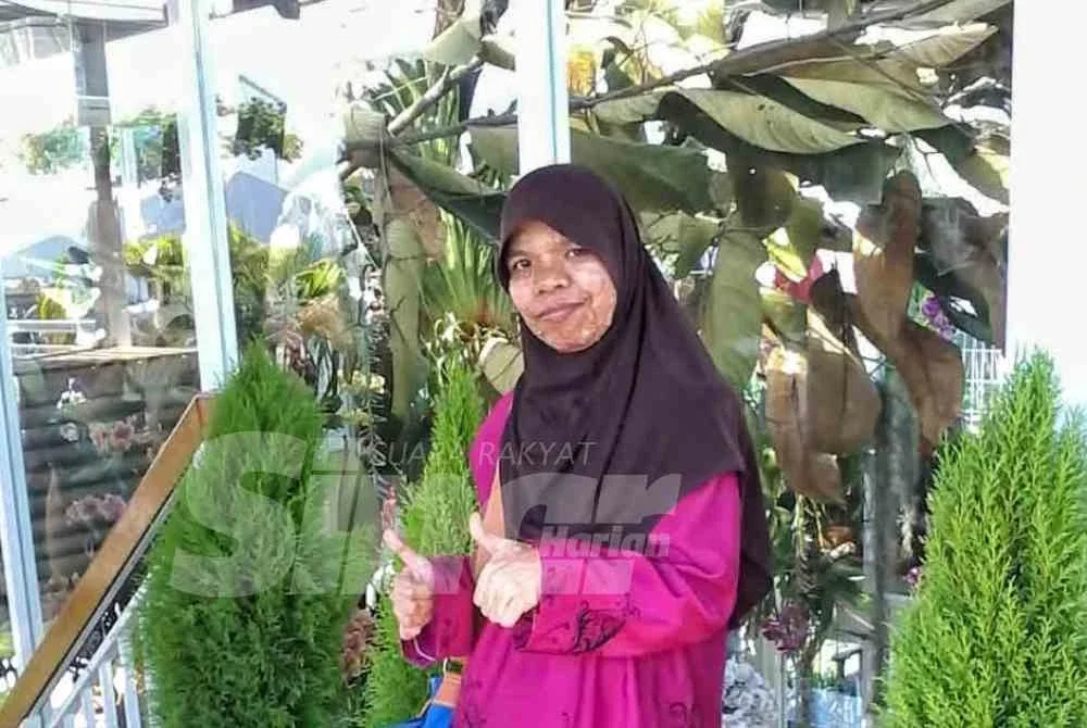 Kak Noor ketika wajahnya masih belum banyak tumbuh lebihan kulit berbiji.