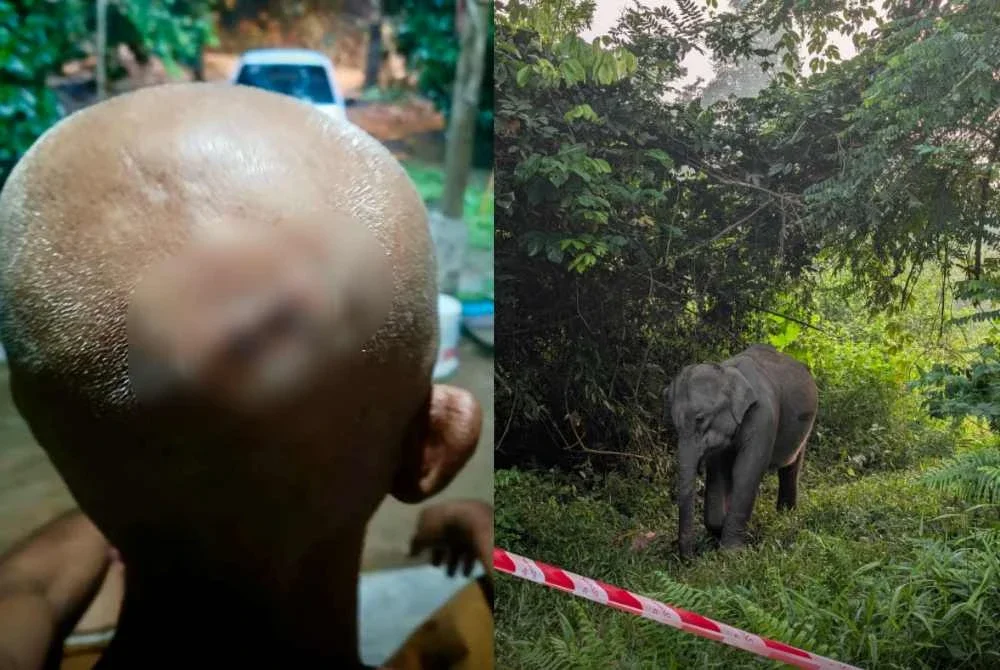 Keadaan kepala Shukri yang dijahit akibat cedera diserang gajah.