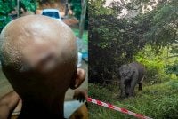 Keadaan kepala Shukri yang dijahit akibat cedera diserang gajah. 