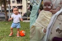 Elnaura menghidap kecacatan jantung kongenital.