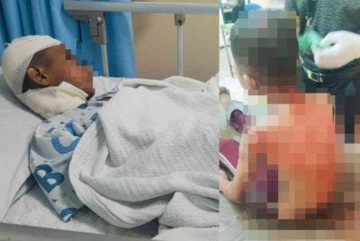 Mangsa cedera di kepala dan leher selepas diserang sekumpulan anjing liar ketika bermain pasir di Pantai Kuala Kemasin pada Khamis.