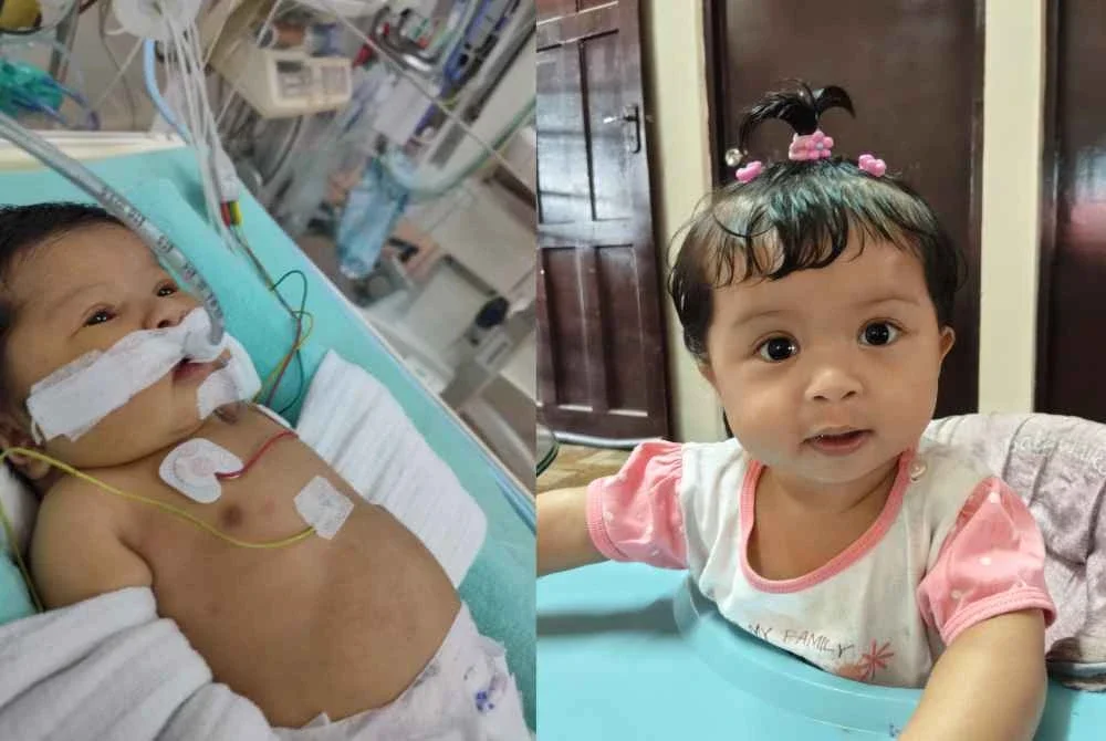 Ketika baru berusia seminggu, Aleeya Mikayla terpaksa menjalani pembedahan bagi memasukkan stent untuk meluaskan saluran darah yang sempit.