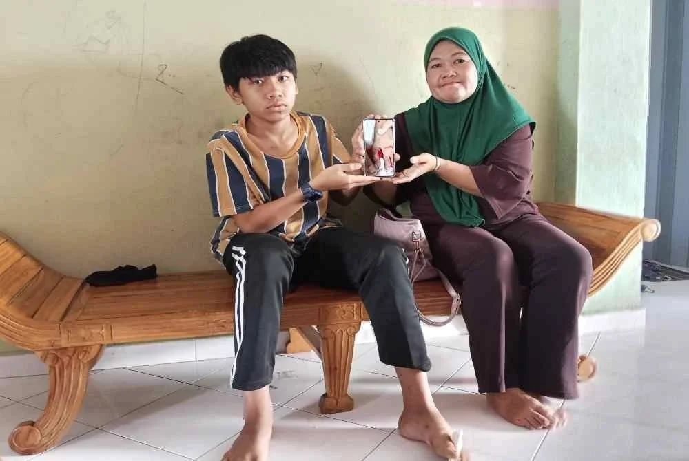 Alif bersama ibunya menunjukkan keadaan kaki yang cedera selepas digigit anjing liar.