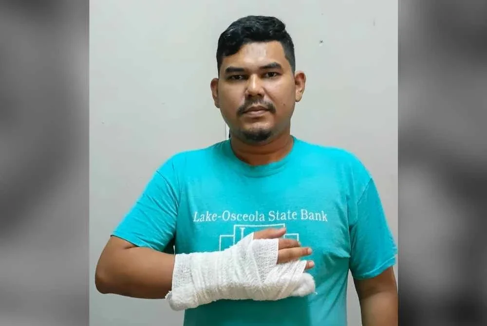 Azrul Azuan menunjukkan keadaan terkini selepas terjatuh ketika membasuh pinggan.