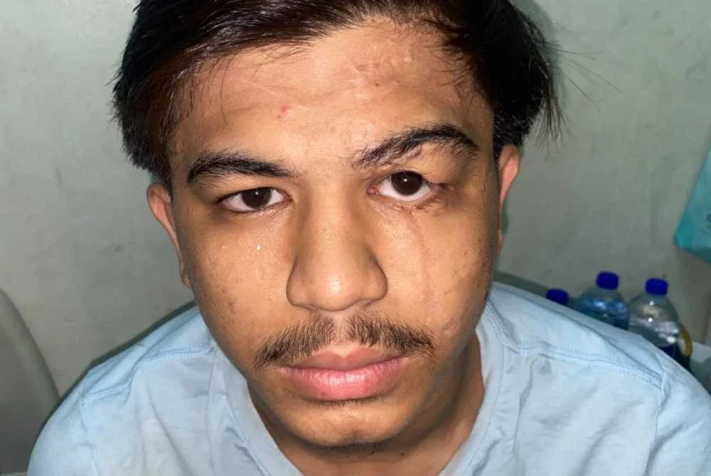 Muhammad Arif Haikal mengalami kecederaan pada muka, retak tulang pipi, mengalami masalah penglihatan serta patah kedua-dua tulang betis selepas terbabit dalam kemalangan akibat dilanggar pemandu mabuk tahun lalu.