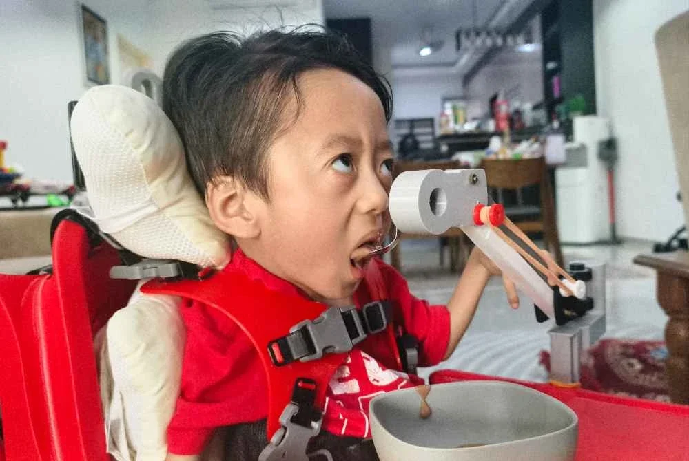 Eilman menggunakan alat bantu makan yang dihasilkan Ameer Adwan